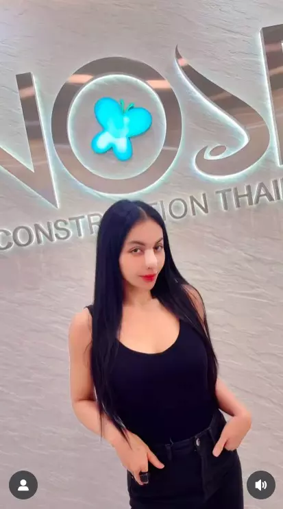 Denada setelah tiga kali operasi plastik © Instagram Denada setelah tiga kali operasi plastik © Instagram