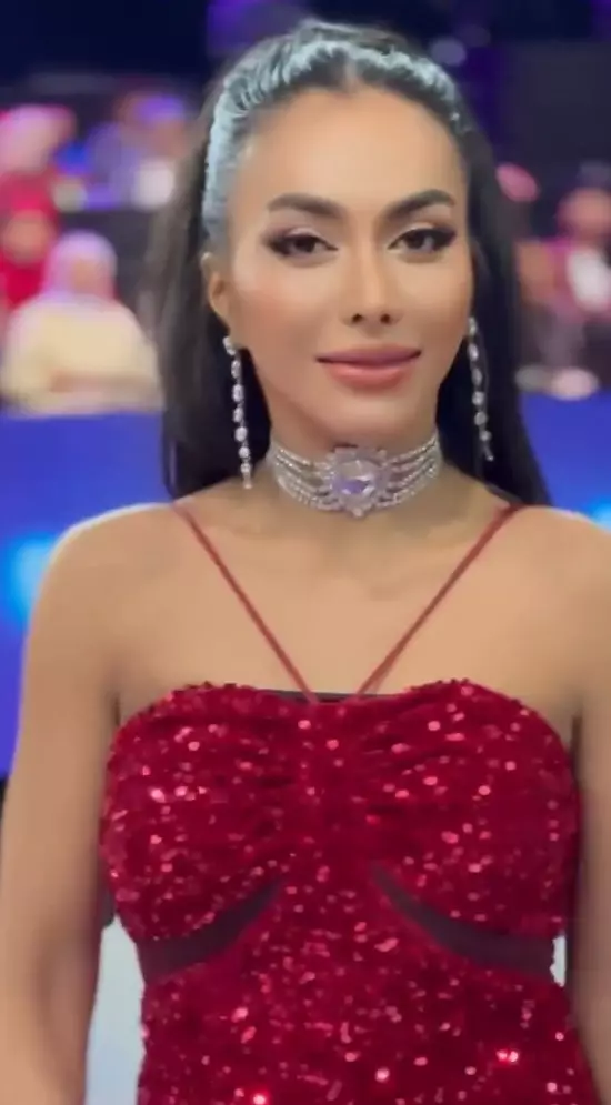 Denada setelah tiga kali operasi plastik © Instagram Denada setelah tiga kali operasi plastik © Instagram