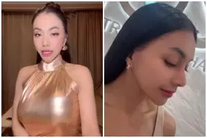 9 Potret terbaru Denada setelah tiga kali operasi plastik, tampilannya kini bikin lupa wajah aslinya