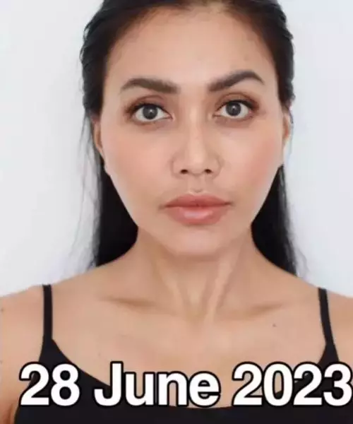 Transformasi Denada oplas hidung di Thailand © 2025 brilio.net