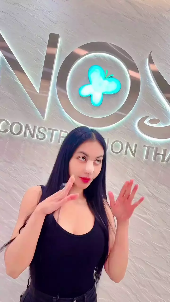 Transformasi Denada oplas hidung di Thailand © 2025 brilio.net