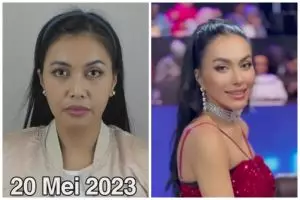 9 Potret transformasi Denada usai oplas di Thailand, hidung mancungnya bikin pangling