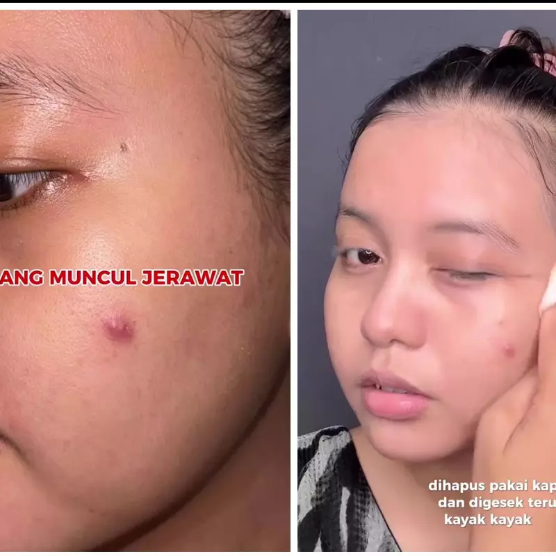 Tak perlu kapas, ini trik hapus makeup waterproof agar bersih maksimal tanpa bikin kulit jerawatan