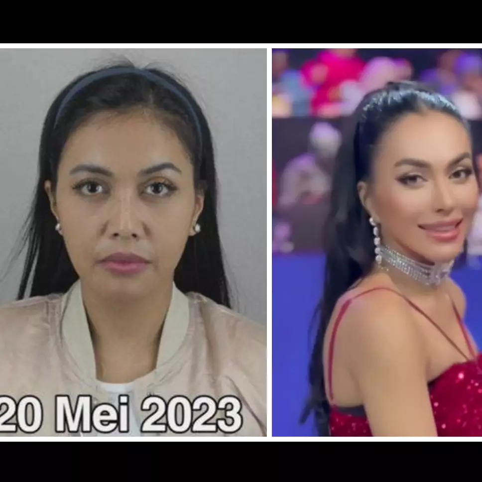 Pengakuan gamblang Denada sengaja operasi plastik, demi estetika untuk bertahan di industri hiburan