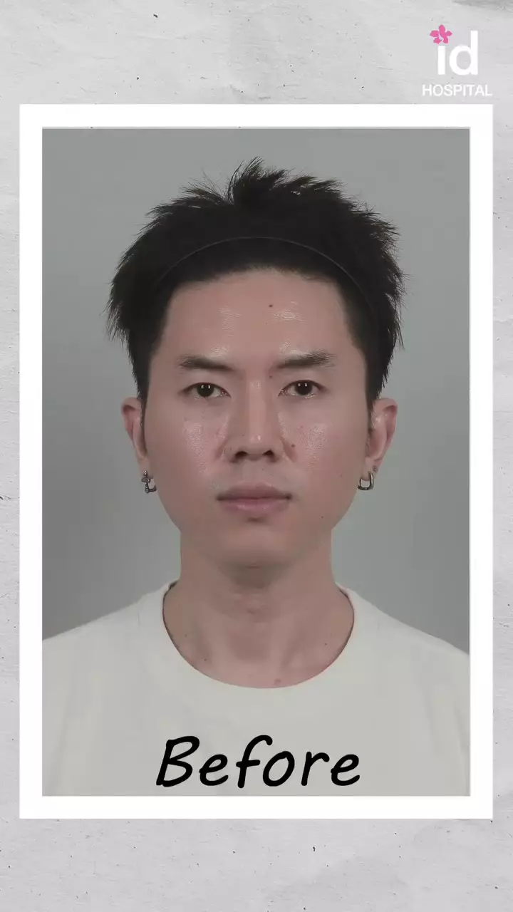 Rafael Tan operasi plastik © 2025 Instagram Rafael Tan operasi plastik © 2025 Instagram