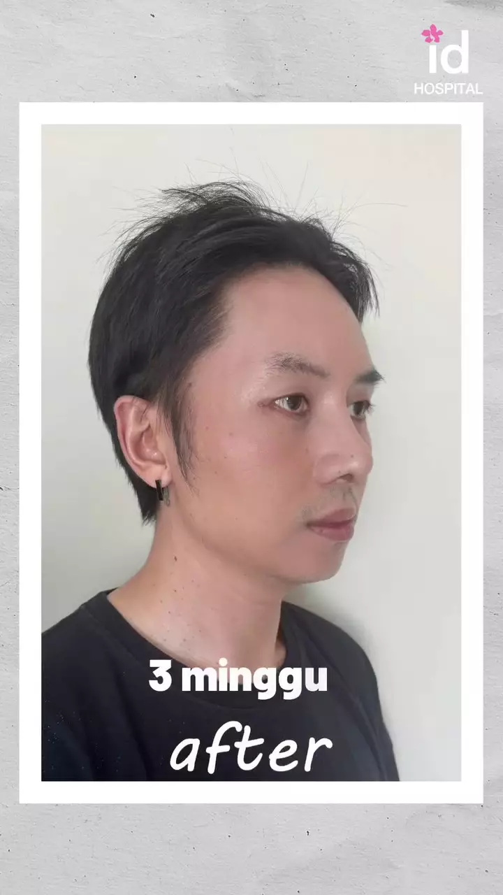 Rafael Tan operasi plastik © 2025 Instagram Rafael Tan operasi plastik © 2025 Instagram