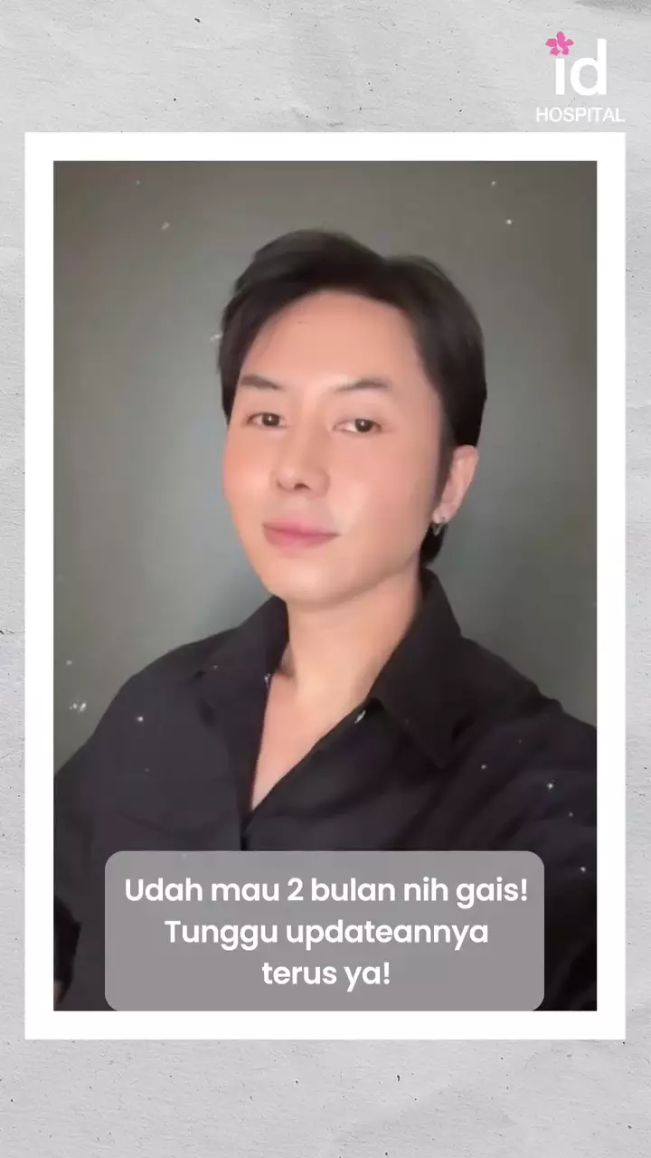 Rafael Tan operasi plastik © 2025 Instagram Rafael Tan operasi plastik © 2025 Instagram