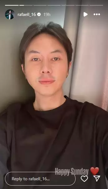 Rafael Tan operasi plastik © 2025 Instagram Rafael Tan operasi plastik © 2025 Instagram