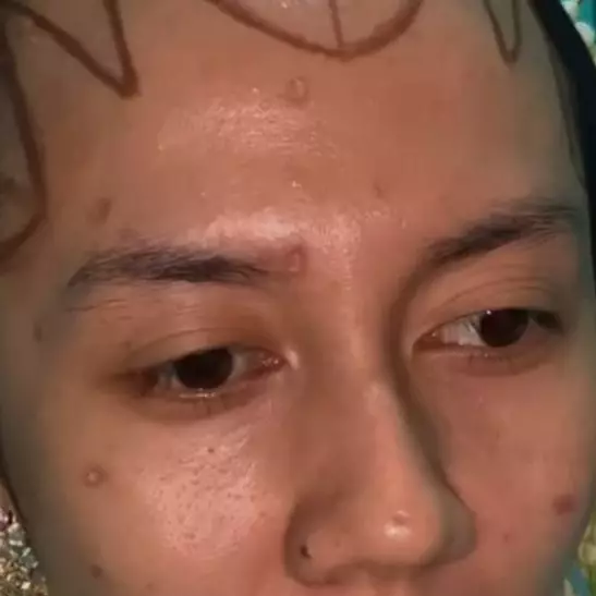 Bekas cacar hilang, transformasi makeup pengantin adat Jawa ini hasilnya bikin nggak nyesal pilih MUA