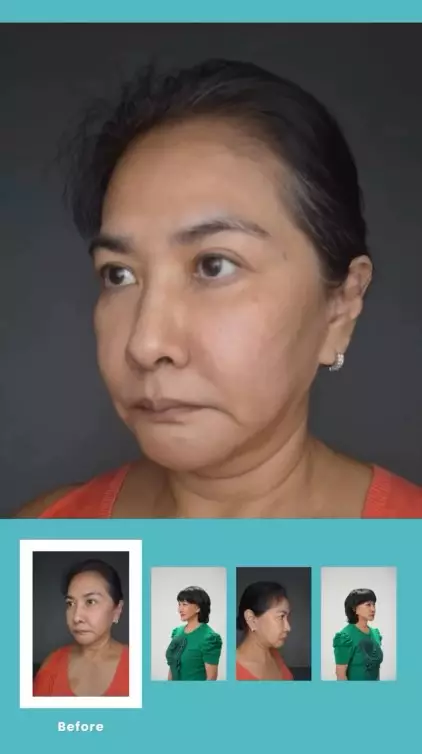 transformasi Yurike Prastika oplas anti aging © Instagram