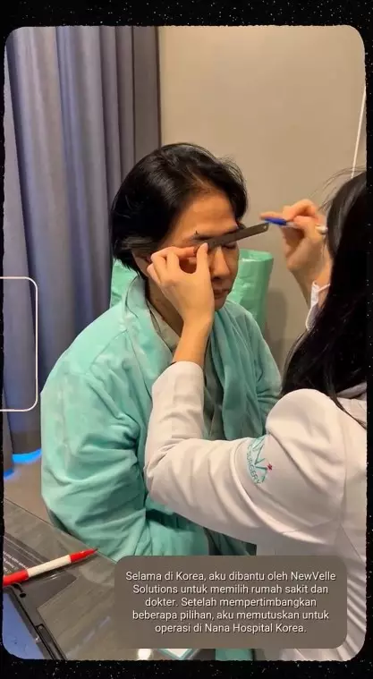 transformasi Yurike Prastika oplas anti aging © Instagram