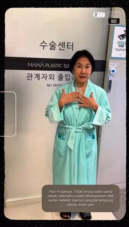 transformasi Yurike Prastika oplas anti aging © Instagram