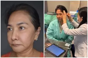 Yurike Prastika oplas anti-aging di Korea Selatan, 9 transformasinya jadi terlihat 10 tahun lebih muda