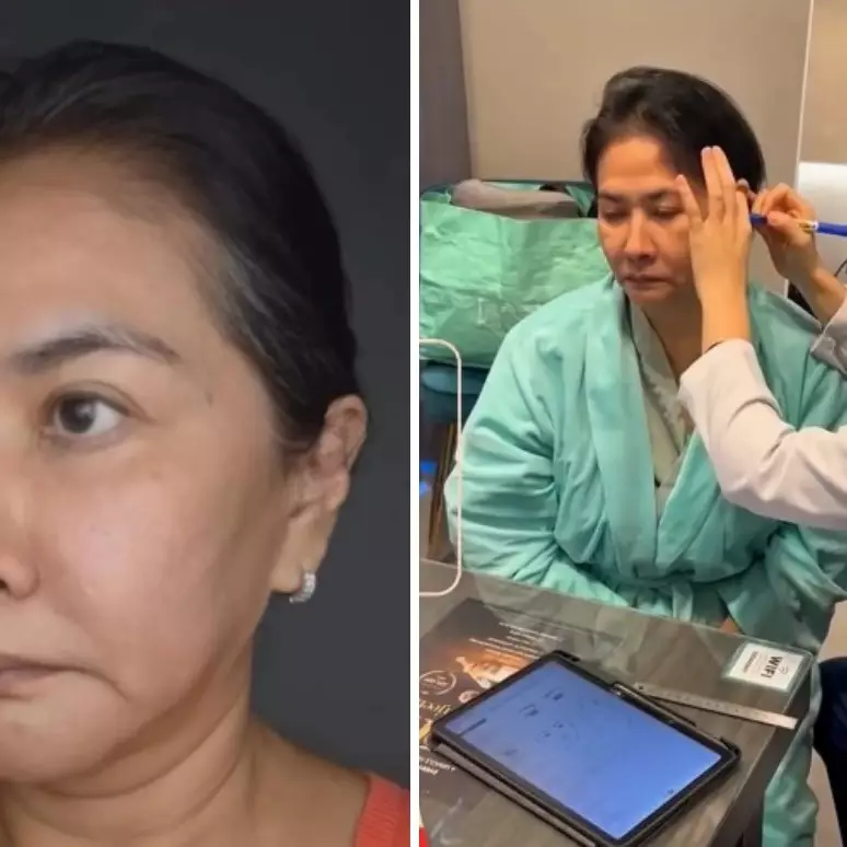 Yurike Prastika oplas anti-aging di Korea Selatan, 9 transformasinya jadi terlihat 10 tahun lebih muda