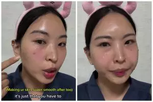 Tak perlu masker khusus, cara mudah kecilkan pori-pori ini bikin wajah mulus bermodal 1 bahan dapur