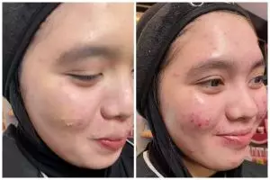 Salah pilih shade cushion bikin dempul, perubahan cewek dirias ulang ini auto mulus bak tanpa tekstur