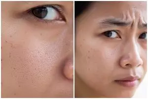 Sering diabaikan, ini 7 kebiasaan sepele penyebab pori-pori membesar dan wajah kusam