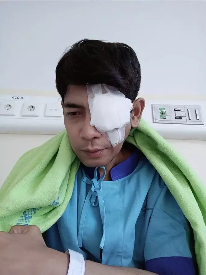 Veri AFI operasi ablasio retina mata kiri © 2025 Instagram