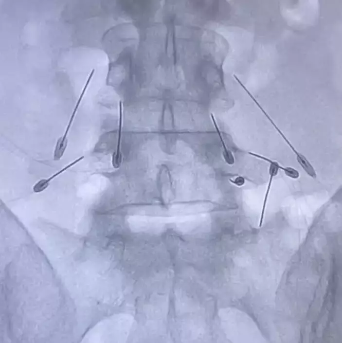 Potret Ferry Maryadi dirawat di rumah sakit © 2025 brilio.net Potret Ferry Maryadi dirawat di rumah sakit © 2025 brilio.net