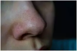 Cara mudah menghaluskan wajah dan mengecilkan pori-pori pakai bahan alami, andalkan 1 kulit buah