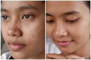 Urutan skincare paling efektif untuk pori-pori besar, rahasia kulit mulus dan glowing tanpa ribet