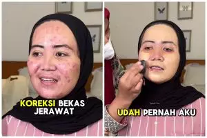 Punya jerawat kemerahan, transformasi pengantin jadi mulus bak perawatan usai dirias Korean makeup 