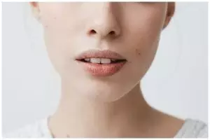 Bibir gelap akibat hiperpigmentasi? Ini cara mencerahkannya agar pink alami tanpa bikin kering