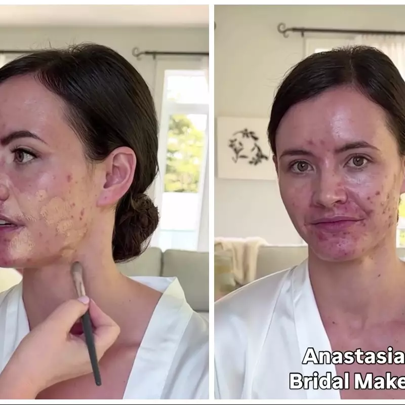 MUA ini pilih complexion tipis saat rias pengantin berjerawat meradang, transformasinya bikin melongo