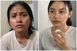 Kulit berminyak? Ini 7 tips skincare terbaru 2025 yang bikin wajah bebas kilap