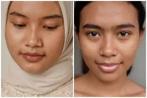 Pori-pori wajah membesar? Begini 7 cara merawatnya tanpa bikin kulit sensitif kemerahan