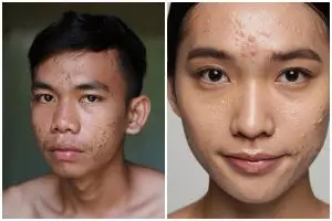 Jangan disamakan, ini perbedaan pori-pori pria dan wanita serta cara tepat merawatnya