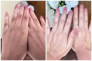 Bukan scrub atau produk eksfoliasi, ini cara baru atasi punggung tangan belang pakai 1 bahan dapur