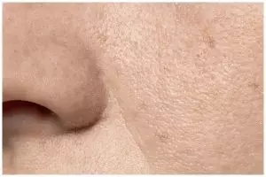 Buah satu ini bisa kecilkan pori-pori wajah dalam sekali pakai, ampuh cuma perlu tambah 1 bahan dapur