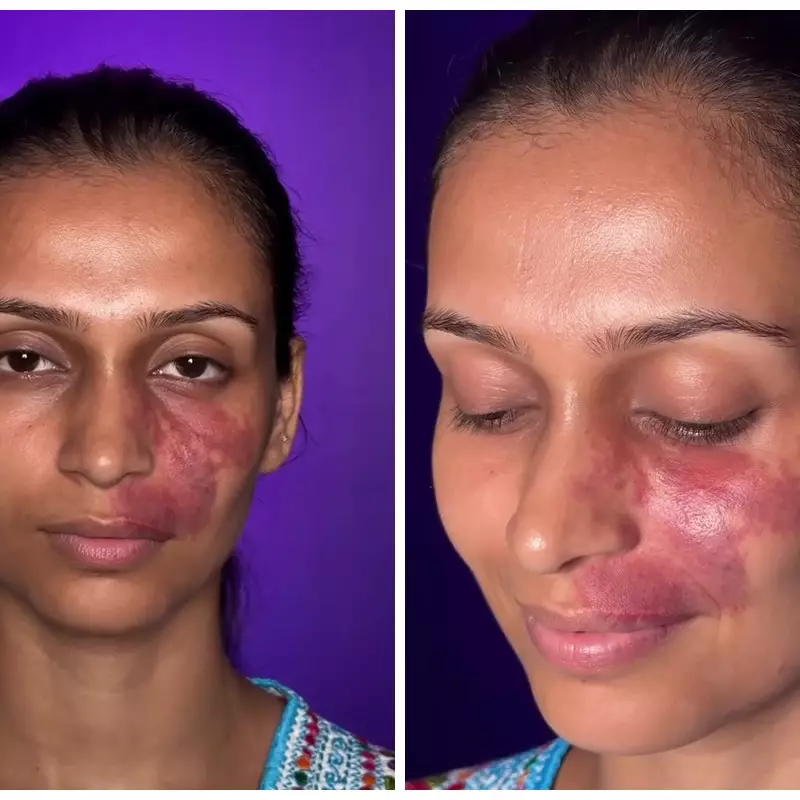 Bekas luka tertutup sempurna, transformasi makeup wanita dirias nude ini hasilnya bikin melongo