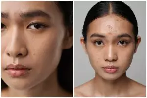 Sudah skincare-an tapi masih kusam? Mungkin ini 1 hal yang kamu lupa