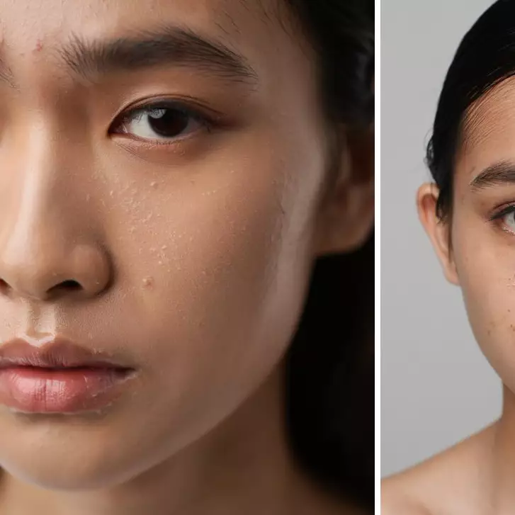 Sudah skincare-an tapi masih kusam? Mungkin ini 1 hal yang kamu lupa