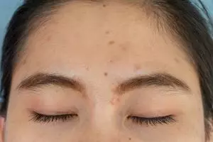 Flek hitam minggat warna kulit jadi lebih rata pakai 1 jenis minuman, ini cara buatnya tanpa ribet