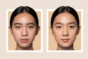 Wajah mulus tanpa produk mahal, ini 6 tips mengecilkan pori-pori dalam waktu singkat