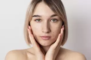 Kulit auto mulus, begini cara membersihkan pori-pori wajah dari komedo pakai 2 bahan dapur