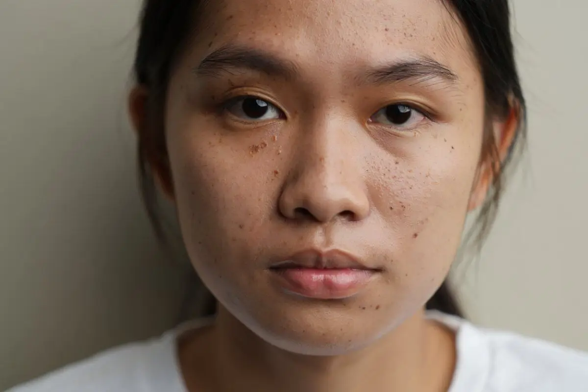5 Masker alami penghilang komedo paling ampuh, bisa bikin kulit mulus seketika