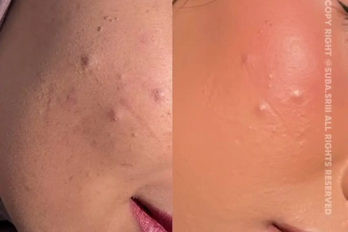 Pakai bedak padat masih sering cakey? Begini cara pakainya agar lebih flawless meski tanpa foundation