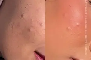 Pakai bedak padat masih sering cakey? Begini cara pakainya agar lebih flawless meski tanpa foundation