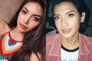 Wajahnya berubah 180 derajat usai filler bibir, intip 11 transformasi Millen Cyrus yang tuai sorotan