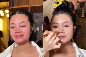 Kulit kemerahan karena bekas jerawat, transformasi makeup cewek ini auto flawless bak hasil perawatan