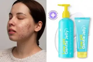 10 Rekomendasi makeup skincare untuk kulit berjerawat, aman untuk wajah nggak bikin breakout