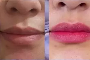 Cuma butuh 2 minggu, ini rahasia cerahkan bibir gelap dan kusam jadi pink alami tanpa bahan kimia