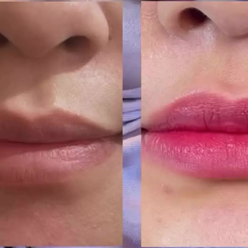 Cuma butuh 2 minggu, ini rahasia cerahkan bibir gelap dan kusam jadi pink alami tanpa bahan kimia