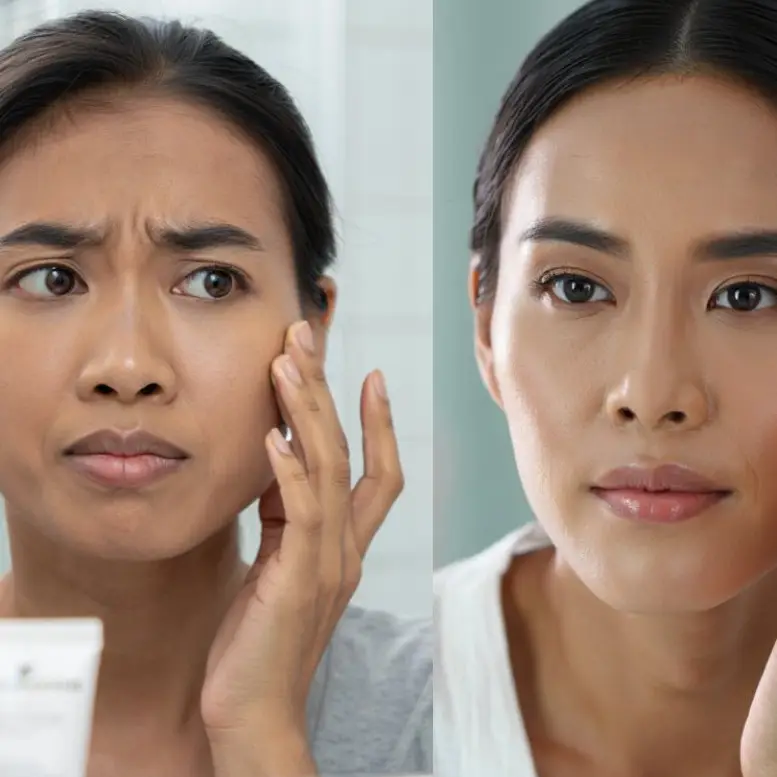 Beda Usia beda strategi, ini skincare dan perawatan wajah yang tepat untuk usia 30, 35, dan 40 tahun