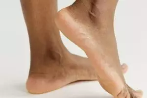 Tumit kaki pecah-pecah dan berwarna hitam? Haluskan pakai 1 bahan herbal, auto mulus dalam 10 menit