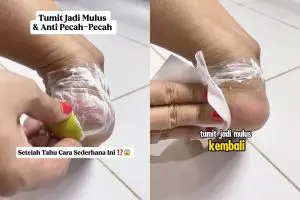 Tumit kering dan pecah-pecah auto mulus dalam 10 menit bermodal 3 bahan dapur, begini cara pakainya